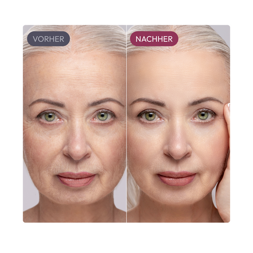 Ayleno Madeca Time Reverse Cream