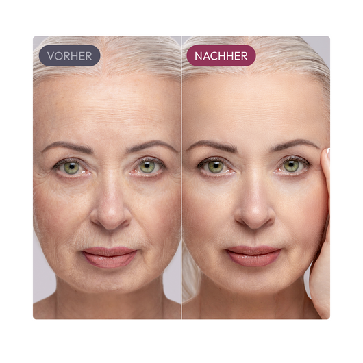 Ayleno Madeca Time Reverse Cream