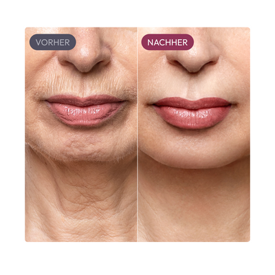 Ayleno Madeca Time Reverse Cream