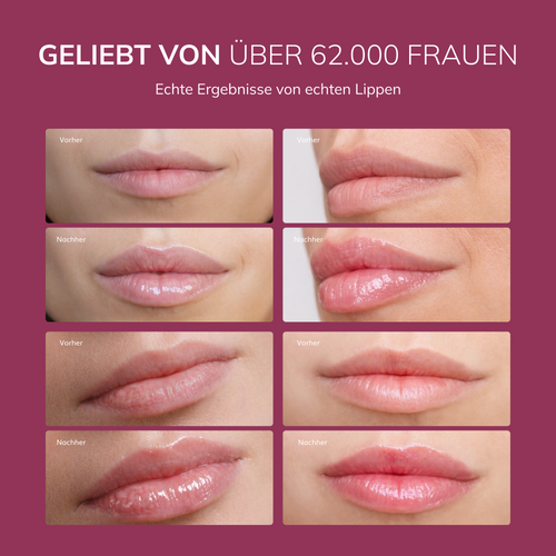 Ayleno Soft Plump Gloss