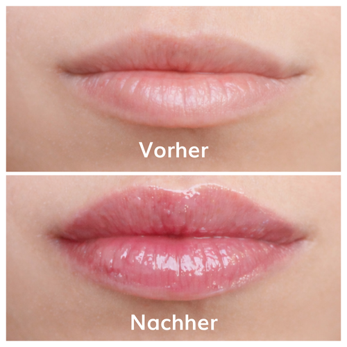 Ayleno Soft Plump Gloss