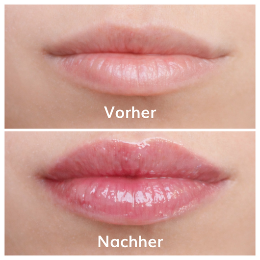 Ayleno Soft Plump Gloss